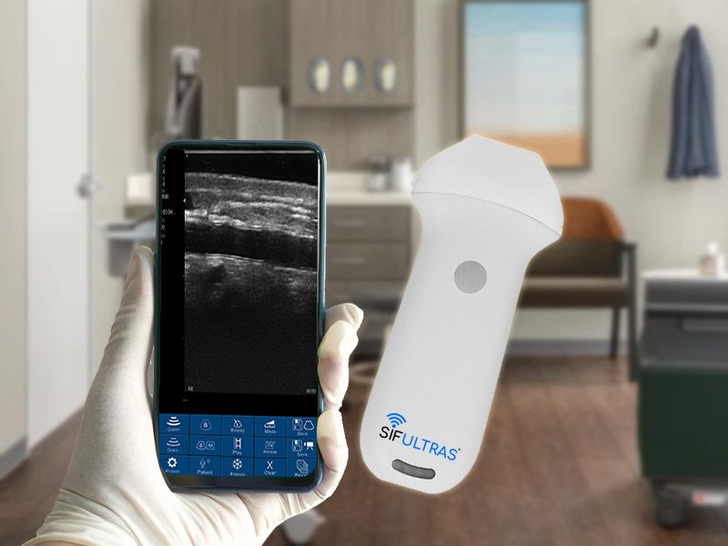 High-Frequency Linear Ultrasound Scanner