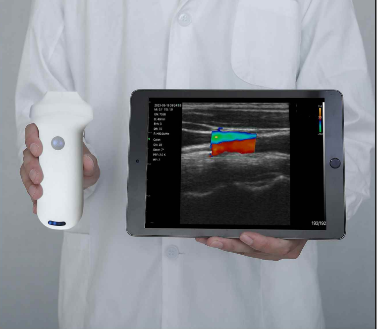 Wireless Ultrasound with 5 Interchangeable Probes
