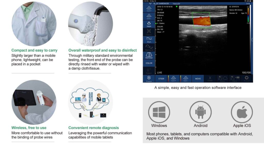 Wireless Ultrasound with 5 Interchangeable Probes