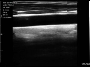 linear ultrasound machine