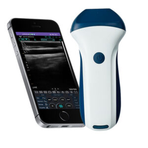 mini linear ultrasound machine