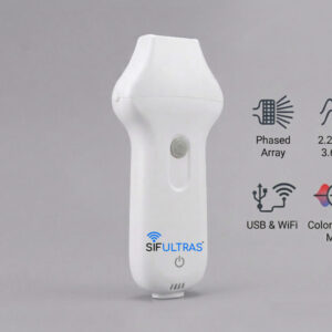 phased array ultrasound scanner