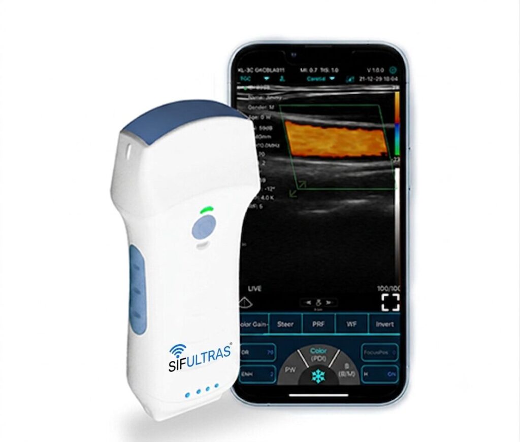 Dual Head Pocket Ultrasound