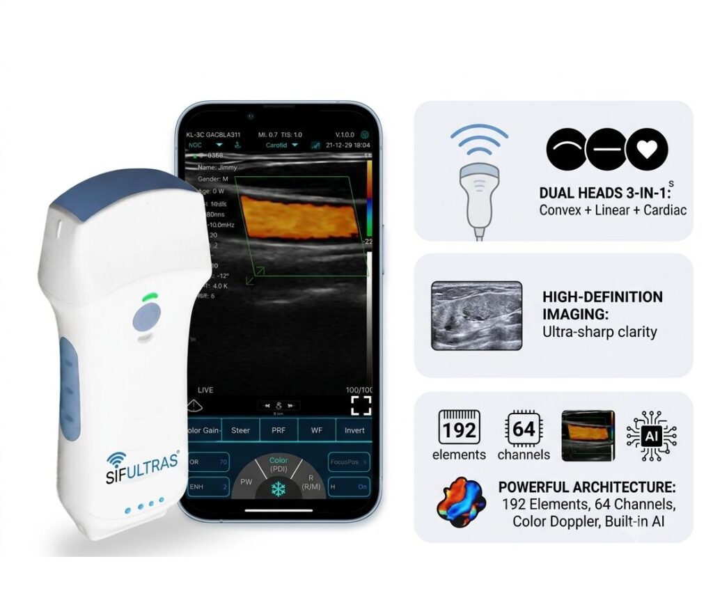 BUILT IN AI ULTRASOUND MACHINE