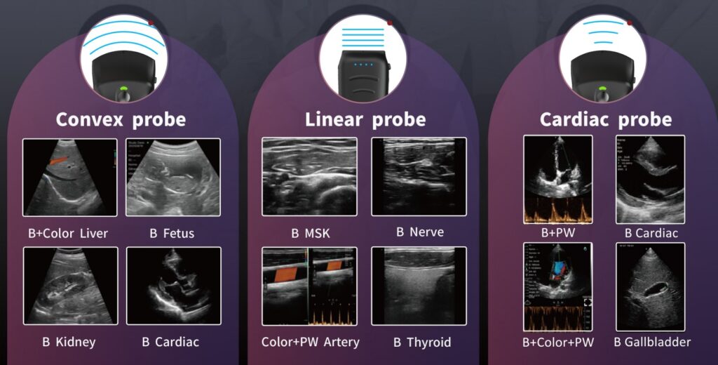 POINT OF CARE ULTRASOUND SCANNER
