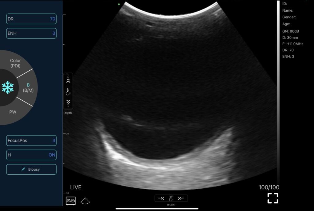 OPHTHALMIC ULTRASOUND MACHINE